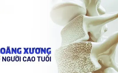 Tại sao loãng xương thường xảy ra ở người lớn tuổi?