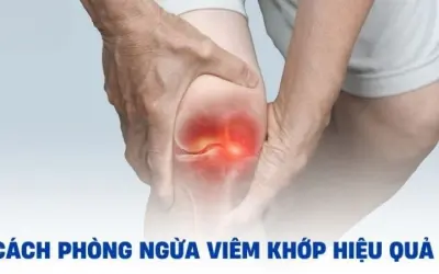 Làm thế nào để phòng ngừa viêm khớp hiệu quả nhất?
