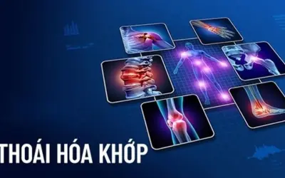 Thoái hóa khớp là gì? Nhận biết qua triệu chứng phổ biến