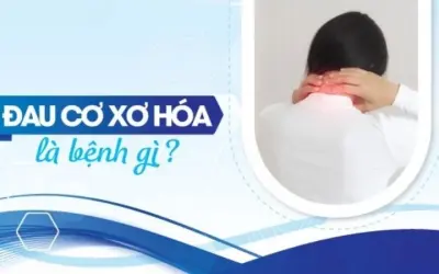 Tại sao đau cơ xơ hóa lại khó chẩn đoán chính xác?