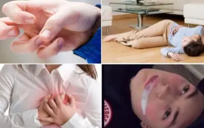 Triệu chứng của động kinh là gì và cách nhận biết sớm