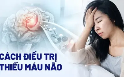 Tại sao thiếu máu lên não lại tiềm ẩn nhiều nguy hiểm?