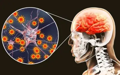Triệu chứng cảnh báo viêm não nguy hiểm không nên bỏ qua
