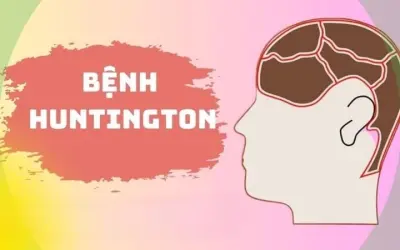 Giải mã nguyên nhân khiến Huntington khó điều trị