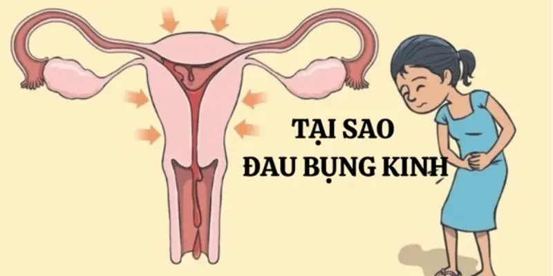 Tại sao đau bụng kinh nguyệt lại phổ biến ở phụ nữ?