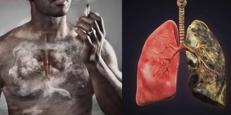 Tại sao hút thuốc lá là nguyên nhân gây ung thư phổi?