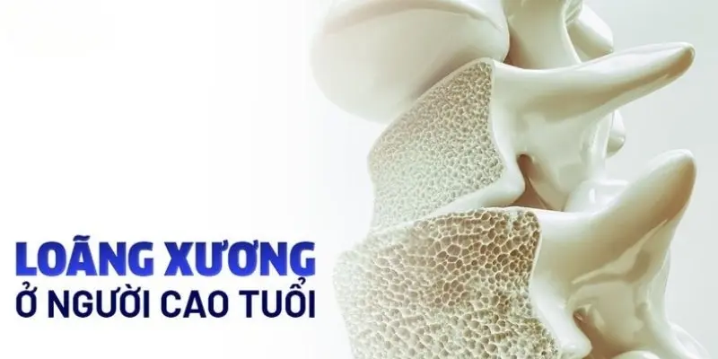 Tại sao loãng xương thường xảy ra ở người lớn tuổi?