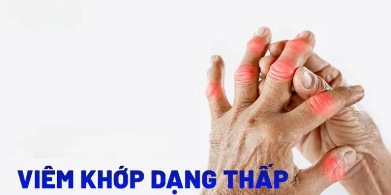 Bệnh viêm khớp dạng thấp được điều trị như thế nào?