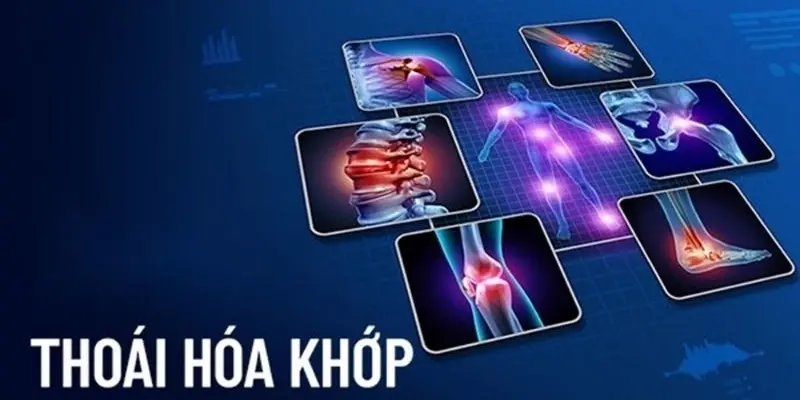 Thoái hóa khớp là gì? Nhận biết qua triệu chứng phổ biến