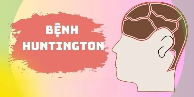 Giải mã nguyên nhân khiến Huntington khó điều trị