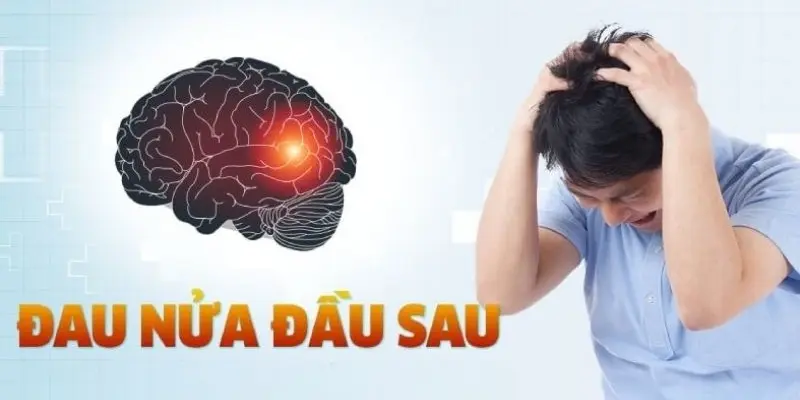 Làm thế nào để điều trị đau nửa đầu hiệu quả và an toàn?