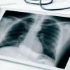 X-ray là gì? Khám phá kỹ thuật chẩn đoán hình ảnh cốt lõi