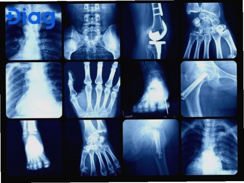 Các hình ảnh phim chụp X-Quang các bộ phận cơ thể.