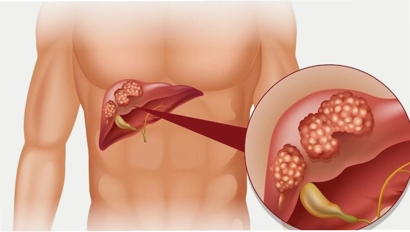 Cận cảnh dụng cụ y tế cần thiết cho việc truyền nước biển tại nhà
