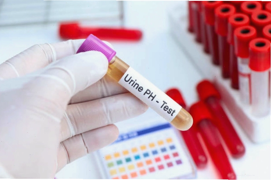 Cận cảnh hình ảnh kiểm tra nồng độ pH của nước tiểu bằng que thử