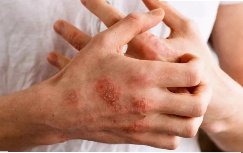 Minh họa các loại thuốc và tác dụng ức chế