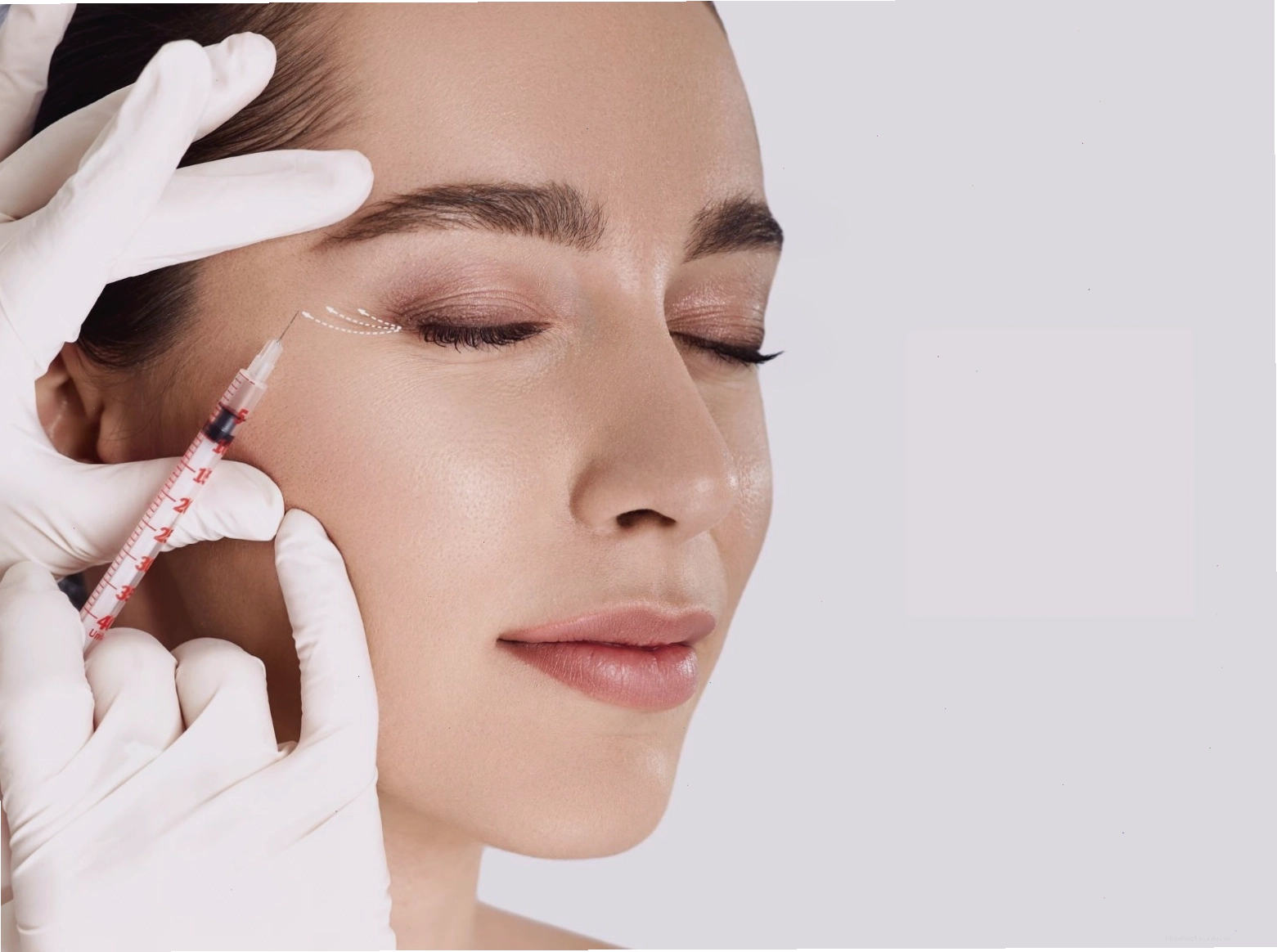 Phân tích chi phí tiêm meso theo từng vùng điều trị