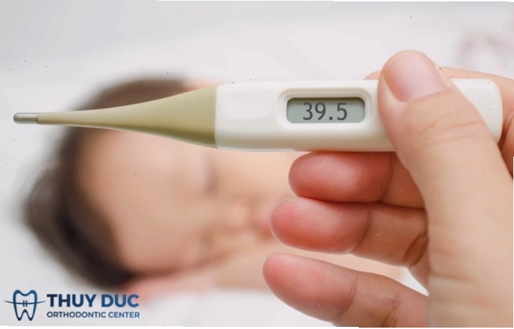 Trẻ bị sốt do mọc răng
