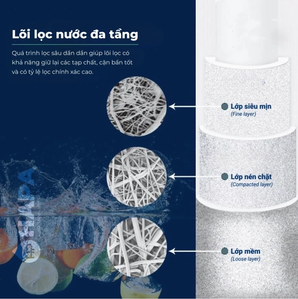 Ưu điểm của lõi lọc nước PP đa tầng