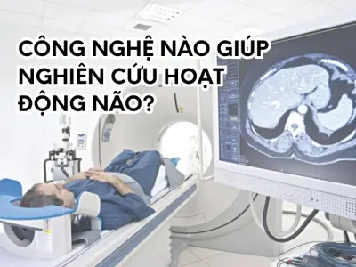 Thiết bị nào đang giúp quan sát hoạt động não người?
