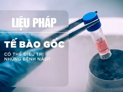 Những căn bệnh có thể chữa nhờ liệu pháp tế bào gốc?
