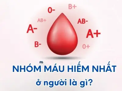 Loại máu hiếm nhất ở người là gì? Giải mã nhóm máu bí ẩn
