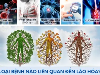 Những loại bệnh phổ biến liên quan đến quá trình lão hóa