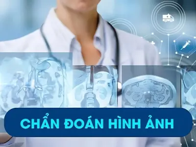 Tìm hiểu chẩn đoán hình ảnh là gì và có ý nghĩa ra sao?