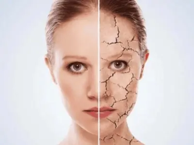 Làm thế nào để nhận biết cơ thể thiếu nước và mất nước?