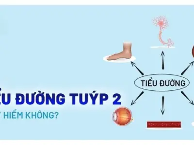 Nhận biết bệnh tiểu đường loại 2 qua dấu hiệu ban đầu