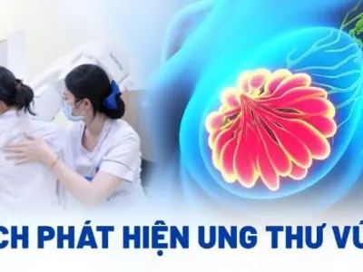 Dấu hiệu nhận biết ung thư vú sớm và cách kiểm tra vú