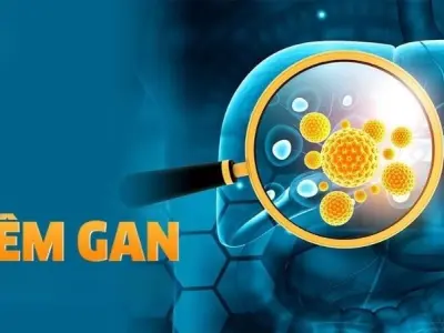 Triệu chứng của bệnh viêm gan là gì? Dấu hiệu cảnh báo