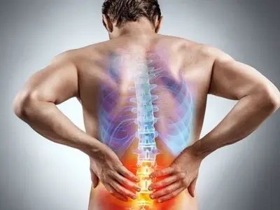 Đau lưng mãn tính do nguyên nhân gì và hướng điều trị