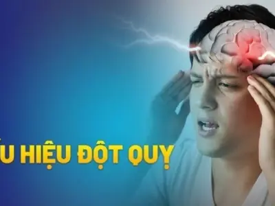 Làm thế nào để nhận biết dấu hiệu đột quỵ kịp thời?