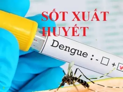 Triệu chứng của sốt xuất huyết là gì và cách phòng tránh