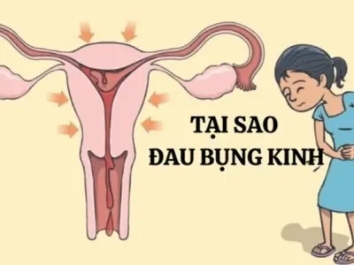Tại sao đau bụng kinh nguyệt lại phổ biến ở phụ nữ?