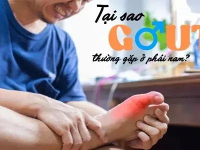 Gout ở nam giới - Nguyên nhân nào làm gia tăng nguy cơ?