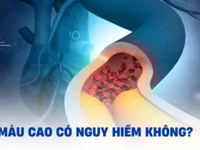 Tại sao mỡ máu cao lại nguy hiểm cho cơ thể con người?