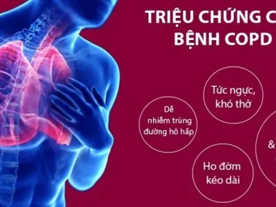 Làm thế nào để phòng ngừa bệnh phổi tắc nghẽn mãn tính?