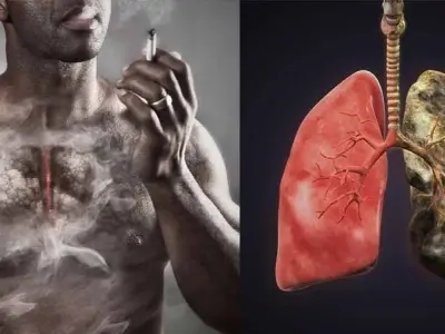 Tại sao hút thuốc lá là nguyên nhân gây ung thư phổi?