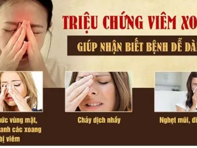 Triệu chứng của viêm xoang là gì và cách nhận biết sớm