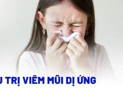Phương pháp điều trị viêm mũi dị ứng được khuyên dùng