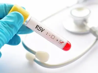 Virus RSV là gì và tại sao lại nguy hiểm cho trẻ em?