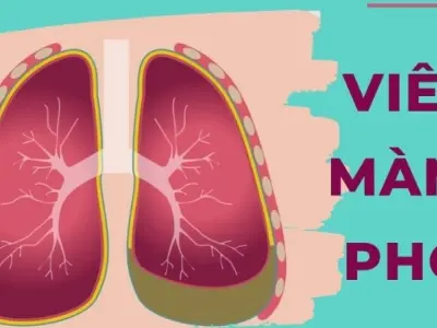 Viêm màng phổi có triệu chứng gì và cách nhận biết sớm?