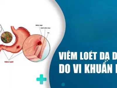 Tại sao vi khuẩn HP là nguyên nhân gây viêm dạ dày?