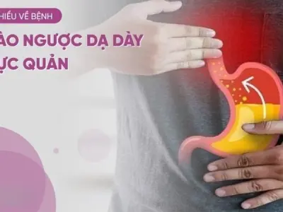 Trào ngược dạ dày thực quản là gì? Có chữa được không