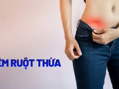 Làm thế nào để nhận biết sớm dấu hiệu viêm ruột thừa?