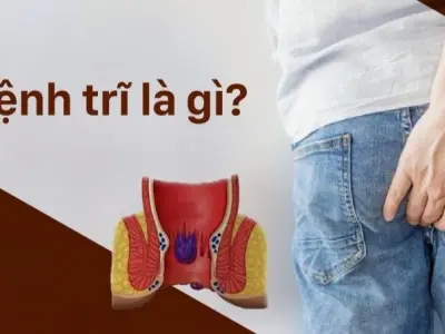 Nguyên nhân phổ biến gây bệnh trĩ ở người lớn tuổi