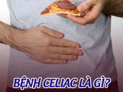 Bệnh Celiac nguy hiểm ra sao? Dấu hiệu bạn cần biết