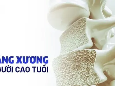 Tại sao loãng xương thường xảy ra ở người lớn tuổi?